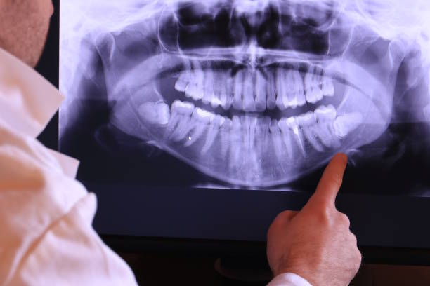 Best Broken or Chipped Tooth Repair in Stony Point, NC